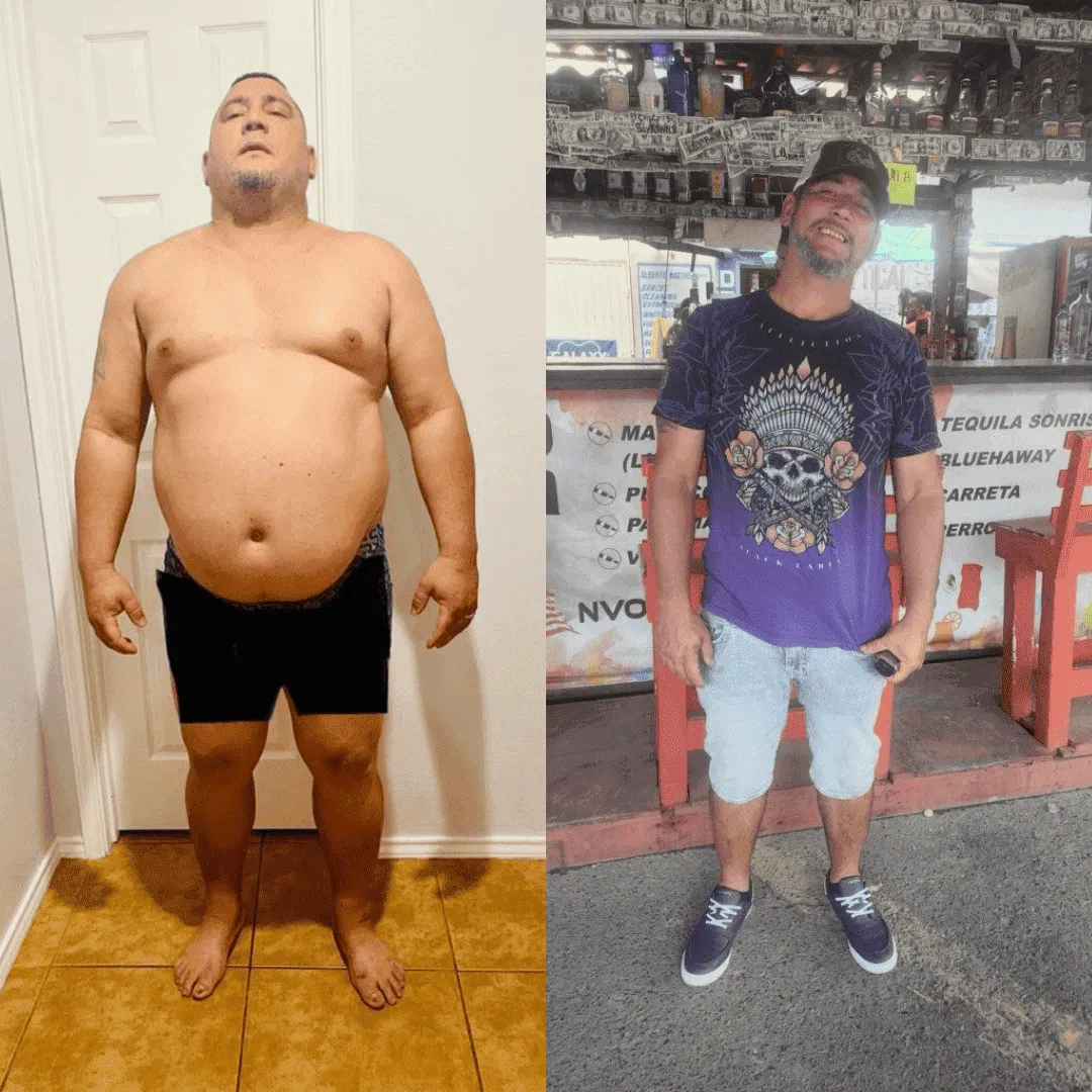 antes (16) (1) (1) (1) (4)