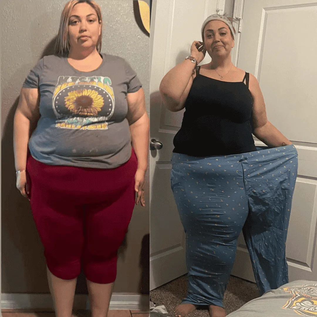 antes (16) (1) (1) (1)